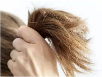 9602c3b8d7bc4b8c5a15c2e4fae8db9 9602c3b8d7bc4b8c5a15c2e4fae8db9